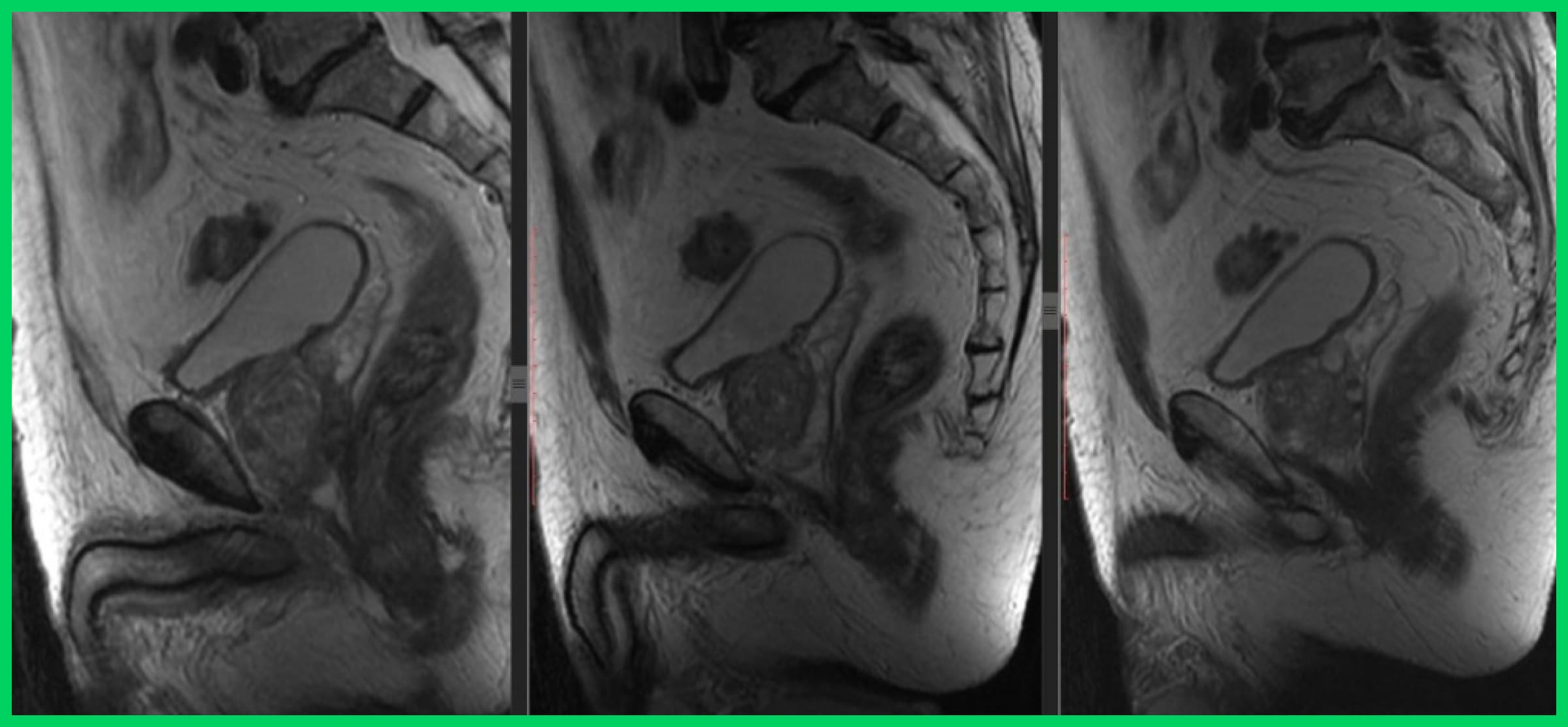 Radiograph